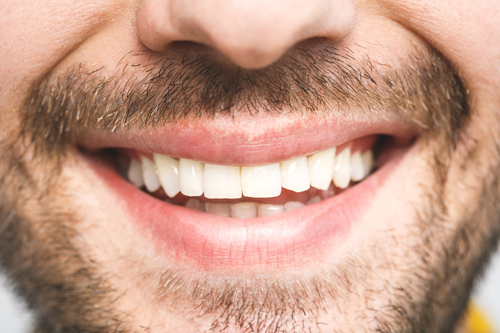 magic dental care Healthy adult (permanent) teeth magic dental care Healthy adult (permanent) teeth
