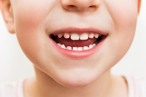 magic dental care Healthy baby (primary) teeth magic dental care Healthy baby (primary) teeth
